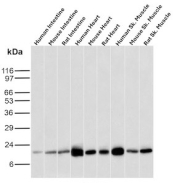 FABP3 Antibody Multi-Tissue WB. Western blot analysis of human intestine, mouse intestine, rat intestine, human heart, mouse heart, rat heart, human skeletal muscle, mouse skeletal muscle, and rat skeletal muscle tissue lysates using FABP3 antibody clone FABP3/3430. A band is detected at approximately 15 kDa across all tested samples, consistent with the predicted molecular weight of Fatty acid-binding protein 3 / FABP3. Stronger signal intensity is observed in cardiac and skeletal muscle lysates, aligning with the known enrichment of FABP3 in highly oxidative tissues that rely on fatty acid transport and aerobic energy metabolism.