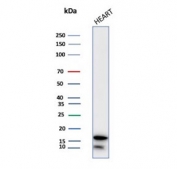 FABP3 Antibody Heart WB. Western blot analysis of human heart lysate using FABP3 Antibody. A dominant band is detected at approximately 14-15 kDa, consistent with the predicted molecular weight of Fatty acid-binding protein 3 / FABP3. A faint lower migrating band is also observed and may represent minor proteolytic processing or a faster-migrating low molecular weight species. The prominent cardiac signal aligns with the established enrichment of FABP3 in cardiomyocytes and its role in intracellular fatty acid transport and oxidative energy metabolism.