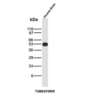 Tubulin Beta Antibody Human Brain WB. Western blot analysis of Tubulin beta 3 (TUBB3) expression in human brain tissue lysate using Tubulin Beta antibody clone TUBB3/7090R. A band is detected at approximately 50-55 kDa, consistent with the predicted molecular weight of TUBB3, supporting detection in neural tissue.