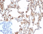 Recombinant ALDH1A1 Antibody Lung IHC. Immunohistochemistry staining of FFPE human lung tissue with recombinant ALDH1A1 antibody (clone rALDH1A1/7285). Negative control inset: PBS used instead of primary antibody to control for secondary Ab binding. HIER: boil tissue sections in pH 9 10mM Tris with 1mM EDTA for 20 min and allow to cool before testing.