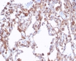 Recombinant ALDH1A1 Antibody Human Lung Tissue IHC. Immunohistochemistry staining of FFPE human lung tissue with recombinant ALDH1A1 antibody (clone rALDH1A1/7285). HIER: boil tissue sections in pH 9 10mM Tris with 1mM EDTA for 20 min and allow to cool before testing.