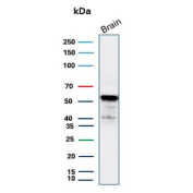 Recombinant ALDH1A1 Antibody Brain WB. Western blot testing of human brain tissue lysate using recombinant ALDH1A1 antibody (clone rALDH1A1/7285). Expected molecular weight ~55 kDa.