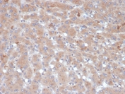Alpha-1-Antichymotrypsin Antibody Immunohistochemistry Liver Staining. IHC analysis of FFPE human liver tissue with Alpha-1-Antichymotrypsin antibody (clone SERPINA3/4189). HIER: boil tissue sections in pH 9 10mM Tris with 1mM EDTA for 20 min and allow to cool before testing.