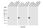 GZMB Antibody in Multi-Species Kidney, Lung and Spleen WB. Western blot testing of GZMB Antibody / Granzyme B in kidney, lung and spleen tissue lysates from human, mouse, rat, hamster, guinea pig and rabbit. A strong band is observed at approximately 29-30 kDa in human kidney, human lung and human spleen, while no corresponding band is detected in the tested mouse, rat, hamster, guinea pig or rabbit tissues. This GZMB Antibody demonstrates detection of endogenous Granzyme B in the tested human tissues.