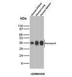 GZMB Antibody in Human Kidney, Lung and Spleen WB. Western blot testing of GZMB Antibody / Granzyme B in human kidney, lung and spleen tissue lysates. Granzyme B is detected as a prominent band at approximately 35-36 kDa in all three tissues, with particularly strong signal in lung. This GZMB Antibody demonstrates detection of endogenous Granzyme B across the tested human tissues.