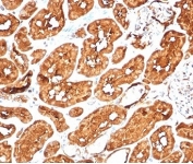 Aldehyde Dehydrogenase 1A1 Antibody Kidney Immunohistochemistry. IHC staining of FFPE human kidney tissue with recombinant Aldehyde Dehydrogenase 1A1 antibody (clone ALDH1A1//7011R). HIER: boil tissue sections in pH 9 10mM Tris with 1mM EDTA for 20 min and allow to cool before testing.