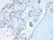 FABP4 Antibody FFPE Human Placenta Tissue IHC. Immunohistochemistry staining of FFPE human placental tissue with FABP4 antibody (clone FABP4/4423) at 2ug/ml. Negative control inset: PBS instead of primary antibody to control for secondary binding. HIER: boil tissue sections in pH 9 10mM Tris with 1mM EDTA for 20 min and allow to cool before testing.