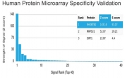 RHOBTB2 Antibody HuProt Microarray Specificity Validation. Analysis of a HuProt(TM) microarray containing more than 19,000 full-length human proteins using RHOBTB2 Antibody / Tumor Suppressor Marker clone DBC2/3361 demonstrates highly selective recognition of Rho-related BTB domain-containing protein 2 / RHOBTB2. The intended RHOBTB2 target ranks first among all proteins analyzed on the array, with exceptionally strong separation from secondary signals, supporting the specificity profile of this mouse monoclonal antibody for tumor suppressor signaling and epithelial cancer biology research applications. Z-score represents signal intensity above background in standard deviation units, while S-score reflects the relative specificity of antibody binding compared with additional proteins present on the HuProt(TM) platform.