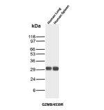 Recombinant Granzyme B Antibody in Human Lung and Spleen WB. Western blot testing of Recombinant Granzyme B Antibody in human lung and spleen tissue lysates. A strong, discrete band is observed at approximately 30 kDa in both tissues. This Recombinant Granzyme B Antibody demonstrates detection of endogenous Granzyme B in the tested human tissues.