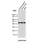 ANXA1 Antibody Human A549 Lung Cancer Cell and Tissue WB. Western blot analysis of human intestine, human lung and A549 lung cancer cell lysates using ANXA1 Antibody (clone rANXA1/6451). Annexin A1 is detected at approximately 37-40 kDa across the samples tested, demonstrating recognition of ANXA1 in human tissues and A549 lung cancer cells.