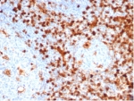 IHC staining of FFPE human tonsil tissue with Annexin A1 antibody (clone ANXA1/6452R). HIER: boil tissue sections in pH 9 10mM Tris with 1mM EDTA for 20 min and allow to cool before testing.