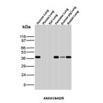 Annexin A1 Antibody Human, Mouse, Rat, Hamster, Guinea Pig and Rabbit Lung WB. Western blot analysis of human, mouse, rat, hamster, guinea pig and rabbit lung tissue lysates using Annexin A1 Antibody (clone rANXA1/9145). Annexin A1 is detected at approximately 37-40 kDa in human, hamster, guinea pig and rabbit lung tissue, with little to no detectable signal observed in the mouse and rat samples under these conditions.