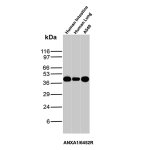 Annexin A1 Antibody Human A549 Lung Cancer Cell and Tissue WB. Western blot analysis of human intestine, human lung and A549 lung cancer cell lysates using Annexin A1 Antibody (clone ANXA1/6452R). Annexin A1 is detected at approximately 37-40 kDa across the samples tested, demonstrating recognition of ANXA1 in human tissues and A549 lung cancer cells.