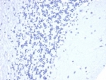 Negative control: IHC staining of FFPE human brain with recombinant CD5 antibody (clone C5/4561R) at 2ug/ml in PBS for 30min RT. HIER: boil tissue sections in pH 9 10mM Tris with 1mM EDTA for 20 min and allow to cool before testing.