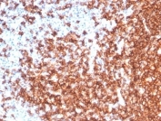 Immunohistochemistry analysis of CD20 Antibody Rabbit Monoclonal in human tonsil tissue. FFPE human tonsil demonstrates strong membranous HRP-DAB brown staining in B lymphocytes within germinal centers and follicular regions, consistent with CD20/MS4A1 surface expression, while adjacent non-B-cell areas show minimal staining. Antigen retrieval was performed by boiling tissue sections in pH 9 10mM Tris with 1mM EDTA for 20 minutes followed by cooling prior to incubation with recombinant CD20 antibody (clone MS4A1/7015R).