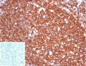 IHC staining of FFPE human tonsil tissue with CD20 antibody (clone MS4A1/7015R). Negative control inset: PBS instead of primary antibody to control for secondary Ab binding. HIER: boil tissue sections in pH 9 10mM Tris with 1mM EDTA for 20 min and allow to cool before testing.