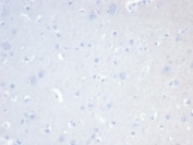 Negative control: IHC staining of FFPE human brain tissue with CD20 antibody (clone MS4A1/7015R) at 2ug/ml in PBS for 30min RT. HIER: boil tissue sections in pH 9 10mM Tris with 1mM EDTA for 20 min and allow to cool before testing.