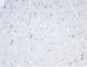 Negative control: IHC staining of FFPE human heart tissue with CD20 antibody (clone MS4A1/7015R) at 2ug/ml in PBS for 30min RT. HIER: boil tissue sections in pH 9 10mM Tris with 1mM EDTA for 20 min and allow to cool before testing.
