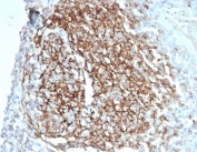 IHC staining of FFPE human spleen tissue with recombinant CD35 antibody (clone CD35/7016R) at 2ug/ml. HIER: boil tissue sections in pH 9 10mM Tris with 1mM EDTA for 20 min and allow to cool before testing.
