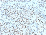 p27Kip1 Antibody Human Bladder Tissue IHC. Immunohistochemistry staining of FFPE human bladder tissue with recombinant p27Kip1 antibody (clone clone KIP1/1355R) at 2ug/ml. HIER: boil tissue sections in pH 9 10mM Tris with 1mM EDTA for 20 min and allow to cool before testing. Strong nuclear staining observed.
