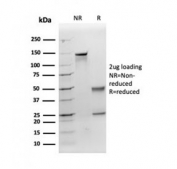 SDS-PAGE analysis of purified, BSA-free Apolipoprotein E antibody (clone APOE/3671) as confirmation of integrity and purity.