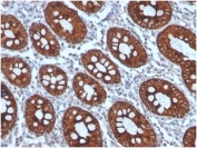 CK8 Antibody Human Colon Tissue IHC. Immunohistochemical staining of FFPE human colon tissue using CK8 Antibody (clone KRT8/4006) demonstrates strong membranous and cytoplasmic HRP-DAB brown staining throughout colonic epithelial cells lining well-defined glandular and crypt structures. The staining pattern is consistent with expression of Cytokeratin 8 (CK8/KRT8), a type II intermediate filament protein widely expressed in simple epithelial tissues where it contributes to cytoskeletal organization, epithelial integrity, and cellular stress-response pathways. CK8 immunoreactivity clearly highlights colonic epithelial architecture and glandular morphology, while surrounding stromal elements exhibit minimal staining. HIER: boil tissue sections in pH 9 10 mM Tris with 1 mM EDTA for 20 minutes and allow to cool before testing.