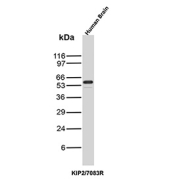 p57Kip2 Antibody Human Brain WB. Western blot analysis of Cyclin-dependent kinase inhibitor 1C (p57Kip2, CDKN1C) expression in human brain tissue lysate using p57Kip2 antibody clone KIP2/7083R. Lane 1: human brain lysate. A band is detected at approximately 55â60 kDa, consistent with the predicted molecular weight of p57Kip2, a cyclin-dependent kinase inhibitor involved in cell cycle regulation and differentiation. The clear signal in brain tissue supports the use of this clone for western blot analysis of neural samples.