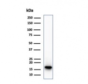 Western blot testing of human HepG2 cell lysate using CDKN2A antibody (clone CDKN2A/7081R). Predicted molecular weight ~16 kDa.
