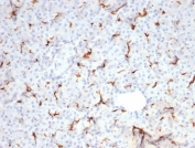 Cystic Fibrosis Transmembrane Regulator Antibody Spleen IHC. Immunohistochemistry analysis of Cystic fibrosis transmembrane conductance regulator / CFTR expression in FFPE human spleen tissue using recombinant rabbit monoclonal antibody clone CFTR/7154R. HRP-DAB brown staining is observed in scattered stromal and vascular-associated cells with membranous and cytoplasmic localization, while the majority of lymphoid cells show minimal signal; nuclei are counterstained blue. This CFTR antibody highlights limited expression consistent with non-epithelial tissue context. Antigen retrieval was performed by boiling sections in 10 mM Tris buffer with 1 mM EDTA, pH 9, for 20 min followed by cooling at room temperature.