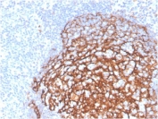 IHC staining of FFPE human tonsil tissue with CD21 antibody (clone CR2/3990R). HIER: boil tissue sections in pH 9 10mM Tris with 1mM EDTA for 20 min and allow to cool before testing.
