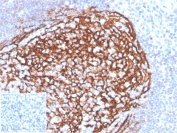 IHC staining of FFPE human tonsil tissue with CD21 antibody (clone CR2/3990R). Negative control inset: PBS instead of primary antibody to control for secondary binding. HIER: boil tissue sections in pH 9 10mM Tris with 1mM EDTA for 20 min and allow to cool before testing.