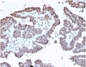 FOXI1 Antibody Prostate IHC. Immunohistochemistry analysis of FFPE human prostate tissue stained with FOXI1 Antibody / Forkhead Box Transcription Factor Marker (clone PCRP-FOXI1-1F8). Nuclear HRP-DAB brown staining is observed in prostate epithelial cells, consistent with the transcription-associated localization expected for Forkhead box protein I1 / FOXI1. Sections underwent HIER using 10mM Tris with 1mM EDTA buffer, pH 9, followed by incubation with FOXI1 antibody at 2ug/ml prior to chromogenic detection.