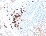 IHC Human IgA Antibody Rabbit Monoclonal IGHA/3877R in human tonsil. Immunohistochemistry analysis of Human IgA Antibody Rabbit Monoclonal IGHA/3877R in formalin-fixed paraffin-embedded human tonsil tissue. The rabbit monoclonal antibody (clone IGHA/3877R) produces strong cytoplasmic HRP-DAB brown staining in plasma cells within the tonsillar lymphoid tissue, consistent with expression of Immunoglobulin alpha heavy chain (IGHA), the heavy chain component of IgA antibodies produced by differentiated B cells. Positive cells are observed predominantly within lymphoid regions where IgA-secreting plasma cells reside, while surrounding lymphocytes show minimal staining. Antigen retrieval was performed by boiling tissue sections in pH 9 Tris-EDTA buffer (10mM Tris, 1mM EDTA) for 20 minutes followed by cooling prior to antibody incubation.