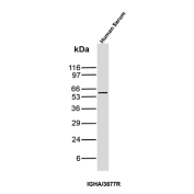 Western blot Human IgA Antibody Rabbit Monoclonal IGHA/3877R in human serum. Human serum lysate was analyzed by western blot using Human IgA Antibody Rabbit Monoclonal IGHA/3877R. A band is detected at approximately 55-60 kDa, consistent with the predicted molecular weight of the Immunoglobulin alpha heavy chain (IGHA), which forms the heavy chain component of IgA antibodies. The detected band corresponds to the IgA heavy chain present in human serum immunoglobulins and reflects the expected migration of reduced IgA heavy chains in SDS-PAGE analysis.