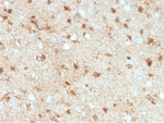 Immunohistochemistry analysis of S100 beta / S100B antibody (clone S100B/4149) in human brain tissue. FFPE human brain demonstrates diffuse cytoplasmic and nuclear HRP-DAB brown staining in astrocyte-like cells distributed throughout the parenchyma, consistent with S100B expression. Staining highlights cells with stellate morphology and branching processes characteristic of astroglial cells, while neuronal cell bodies show comparatively weaker signal. Background staining is minimal under the conditions tested. Nuclei are counterstained blue. Heat induced epitope retrieval was performed by boiling tissue sections in 10 mM Tris with 1 mM EDTA, pH 9.0, for 20 minutes followed by cooling prior to immunostaining.
