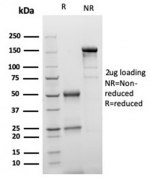 SDS-PAGE analysis of purified, BSA-free S100 beta/S100B antibody (clone S100B/4149) as confirmation of integrity and purity.