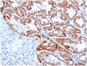 FGF-23 Antibody Protein Microarray Validated FGF23/4169 immunohistochemistry staining of human kidney tissue. IHC analysis of FFPE human kidney was performed using microarray validated FGF-23 antibody clone FGF23/4169 at 2 ug/ml in PBS for 30 min at RT. Heat induced epitope retrieval was performed by boiling tissue sections in pH 9 10 mM Tris with 1 mM EDTA for 20 min followed by cooling before staining. HRP-DAB brown staining highlights epithelial cells within renal tubules, consistent with detection of Fibroblast growth factor 23 / FGF23. Inset shows PBS used in place of primary antibody as a secondary antibody negative control.