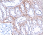 IHC staining of FFPE human kidney tissue with FGF-23 antibody (clone FGF23/4171) at 2ug/ml. Negative control inset: PBS instead of primary antibody to control for secondary binding. HIER: boil tissue sections in pH 9 10mM Tris with 1mM EDTA for 20 min and allow to cool before testing.