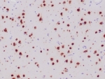 NeuN Antibody Human Ganglioma Tissue Immunohistochemistry. IHC staining of FFPE human ganglioma tissue with recombinant NeuN antibody (clone NeuN/6694R). HIER: boil tissue sections in pH 9 10mM Tris with 1mM EDTA for 20 min and allow to cool before testing.