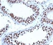 JAZF1 Antibody Testis IHC. Immunohistochemistry analysis of FFPE human testis tissue stained with JAZF1 Antibody / Transcriptional Regulation Protein clone PCRP-JAZF1-1C2 at 2 ug/ml following HIER in pH 9 Tris-EDTA buffer. Strong HRP-DAB brown nuclear staining is observed in seminiferous epithelial cell populations, consistent with expression of JAZF1 as a nuclear zinc finger protein involved in transcriptional regulation and chromatin-associated gene control pathways.
