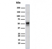 VIM Antibody / Cellular Stress Response Marker Antibody WB. Western blot analysis of human U-87 MG cell lysate using Vimentin antibody detects a band at approximately 55 kDa, consistent with the predicted molecular weight of Vimentin (VIM). The recombinant rabbit monoclonal clone rVIM/6914 shows a distinct band, supporting detection of intermediate filament components associated with stress-responsive cellular states. The presence of Vimentin in U-87 MG cells aligns with cytoskeletal organization linked to cellular stress adaptation and structural responses to environmental conditions.
