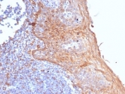 IHC STING1 Antibody Clone STING1/7431 in human tonsil. Immunohistochemistry analysis of STING1 Antibody Clone STING1/7431 in formalin-fixed paraffin-embedded human tonsil tissue. The mouse monoclonal antibody shows cytoplasmic HRP-DAB brown staining in immune cells within tonsillar lymphoid tissue, consistent with the intracellular localization of Stimulator of interferon genes (STING1 / TMEM173), a key adaptor protein in cGAS-STING innate immune signaling. Positive staining is observed in lymphoid and stromal cell populations within the tonsillar architecture. Antigen retrieval was performed by boiling tissue sections in pH 9 Tris-EDTA buffer (10mM Tris, 1mM EDTA) for 20 minutes followed by cooling prior to antibody incubation.