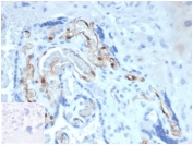 FABP4 Antibody Placenta IHC. Immunohistochemistry analysis of FFPE human placental tissue using FABP4 Antibody / Adipocyte Lipid Metabolism Marker clone FABP4/4424 at 2 ug/ml. Placental stromal and vascular-associated cell populations demonstrate cytoplasmic HRP-DAB brown staining consistent with the role of FABP4 in intracellular fatty acid transport, lipid handling, and metabolic signaling pathways within metabolically active placental tissue. Nuclei are counterstained blue. Inset image shows a PBS-only negative control processed without primary antibody, confirming minimal background staining. Heat-induced epitope retrieval was performed by boiling tissue sections in pH9 10 mM Tris with 1 mM EDTA for 20 minutes followed by cooling prior to staining.