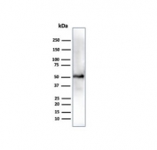 Aldehyde Dehydrogenase 1A1 Antibody HepG2 Cell WB. Western blot testing of human HEPG-2 cell lysate using Aldehyde Dehydrogenase 1A1 antibody (clone ALDH1A1/4793). Expected molecular weight ~55 kDa.