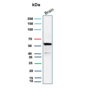 Aldehyde Dehydrogenase 1A1 Antibody Brain WB. Western blot testing of human brain tissue lysate using Aldehyde Dehydrogenase 1A1 antibody (clone ALDH1A1/4793). Expected molecular weight ~55 kDa.