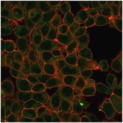 HIC2 Antibody HeLa IF. Immunofluorescence analysis of PFA-fixed human HeLa cells stained with HIC2 Antibody / Transcriptional Regulation Marker (green, clone PCRP-HIC2-1B1) and phalloidin cytoskeletal stain (red). Hypermethylated in cancer protein 2 / HIC2 demonstrates predominantly nuclear and perinuclear staining in human HeLa cells, consistent with the intracellular distribution expected for a zinc finger transcription-associated regulatory protein involved in developmental signaling and nuclear gene expression control.