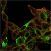 SIRT3 Antibody HeLa Cell IF. Immunofluorescence staining of PFA-fixed human HeLa cells using clone PCRP-SIRT3-1C10 (green) and phalloidin cytoskeletal counterstain (red). Sirtuin 3 / SIRT3 displays punctate cytoplasmic fluorescence consistent with mitochondrial localization, supporting its established role as a mitochondrial metabolism regulator involved in oxidative stress adaptation, energy homeostasis, and mitochondrial acetylation signaling pathways.