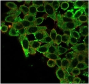 CNOT10 Antibody HeLa IF. Immunofluorescent analysis of PFA-fixed human HeLa cells stained with CNOT10 Antibody demonstrates prominent cytoplasmic and perinuclear green fluorescence consistent with CNOT10 / CCR4-NOT complex-associated regulatory pathway localization. This CCR4-NOT complex protein antibody highlights RNA metabolism-associated signaling and post-transcriptional regulatory pathway organization within epithelial-derived cells. Phalloidin co-staining (red) labels actin-associated cytoskeletal structures.