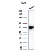 INHA Antibody Recombinant Mouse MAb rINHA/6919 western blot analysis. Western blot testing of human testis tissue lysate using INHA Antibody Recombinant Mouse MAb rINHA/6919. A band is detected at approximately 40 kDa, consistent with the predicted molecular weight of Inhibin subunit alpha (INHA).
