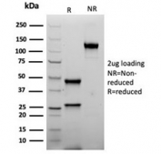 SDS-PAGE analysis of purified, BSA-free recombinant INHA antibody (clone rINHA/6919) as confirmation of integrity and purity.